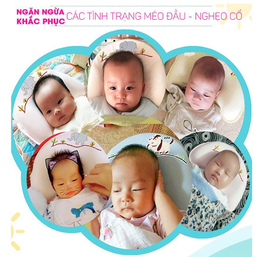 Gối cao su non Babymoov Chính hãng chống bẹp đầu cho bé (Tặng kèm Cẩm nang Phòng chữa méo đầu cho trẻ sơ sinh) 2X MART