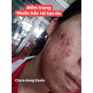Thuốc Bắc Tái Tạo Da