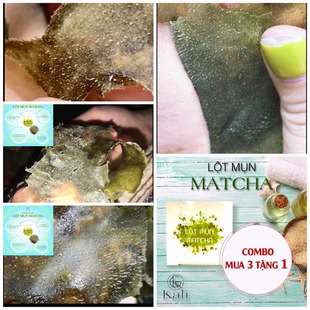 LỘT MỤN MATCHA TRÀ XANH | BigBuy360 - bigbuy360.vn