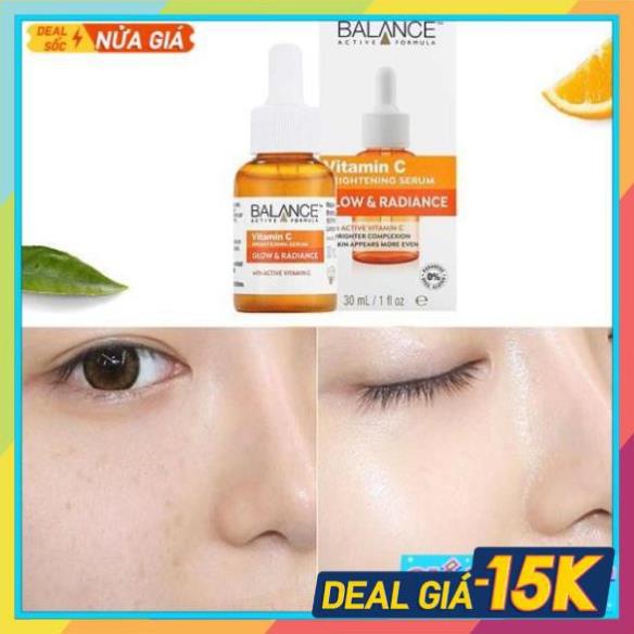 serum vitamin c balance, Trắng Da - Mờ Thâm 30ml NEW | BigBuy360 - bigbuy360.vn