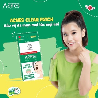 Miếng dán mụn Acnes 24 miếng