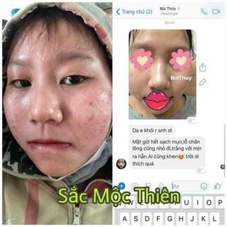 Tinh chất tái tạo da 30ml Sắc Mộc Thiên
