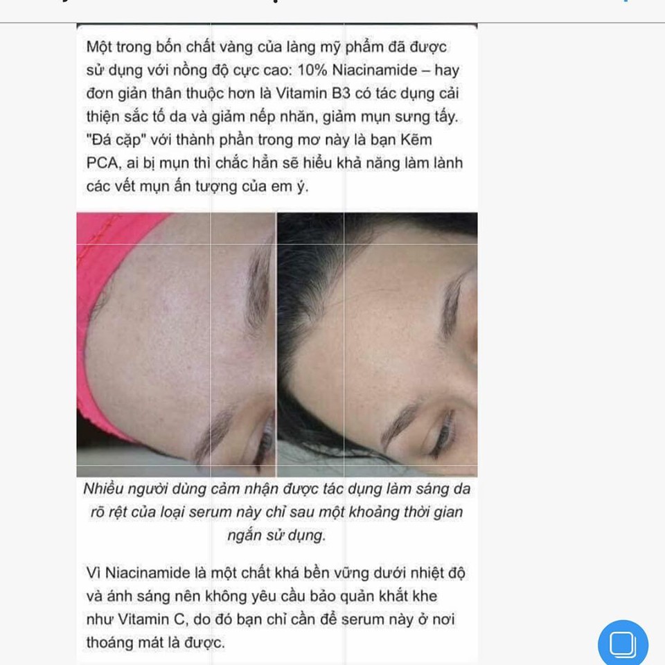 The Ordinary - Niacinamide 10% + Zinc 1% Serum/Tinh Chất Phục Hồi Da 30ml [CANADA] | BigBuy360 - bigbuy360.vn