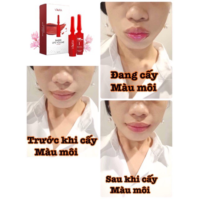 SERUM CAY MOI | BigBuy360 - bigbuy360.vn