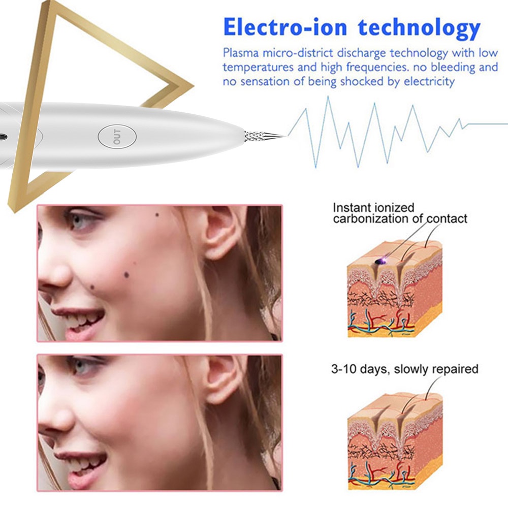 Bút Laser Loại Bỏ Nốt Ruồi / Tàn Nhang / Đốm Đen Trên Da Tiện Dụng