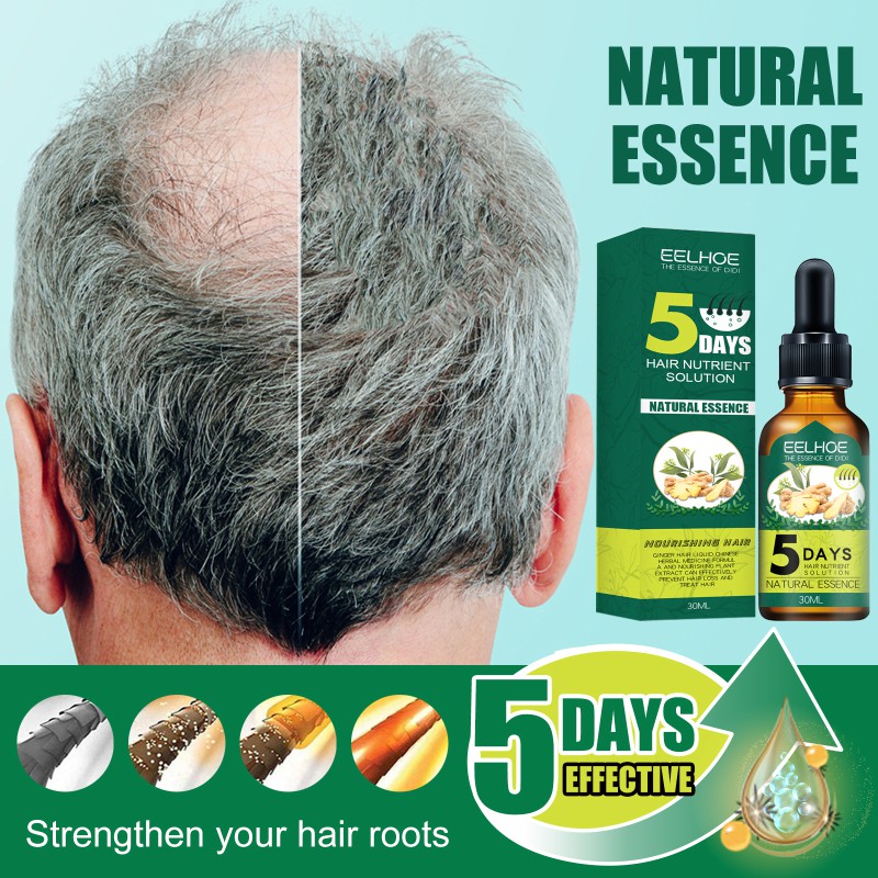 Tinh dầu gừng kích thích mọc tóc hiệu quả dung tích 30ml