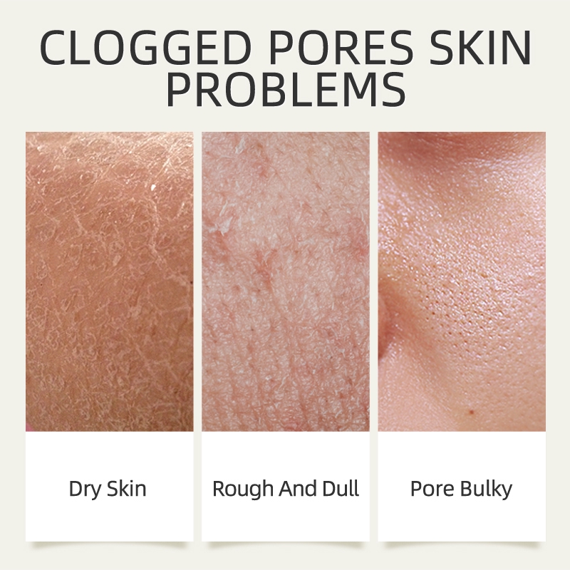 Mặt nạ bùn LAIKOU chiết xuất matcha làm sạch sâu loại bỏ mụn đầu đen 85g