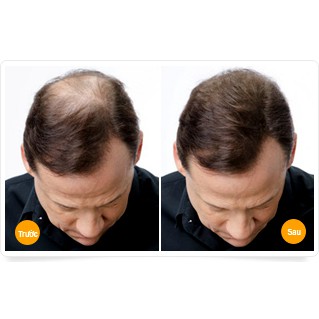 Dầu Gội Thảo Dược Đen Tóc- LICH5, Gội Là Đen, Cocayhoala | BigBuy360 - bigbuy360.vn