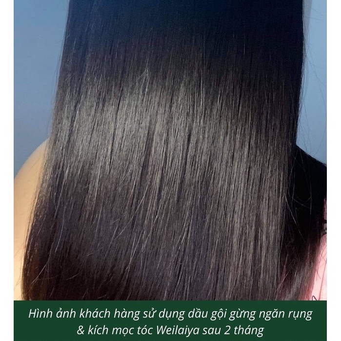 Dầu gội thảo dược Weilaiya ngăn rụng tóc và kích thích mọc tóc chiết xuất thiên nhiên hương nước hoa 400ml
