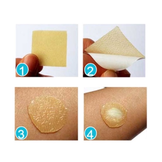 DUODERM Extra Thin Dressing 10PCS 4in*4 in 10cm*10cm băng keo nước