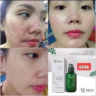SERUM NHÂN SÂM TÁI TẠO DA MSKIN