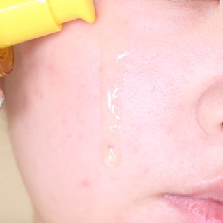 Serum Some by mi mới nhất
