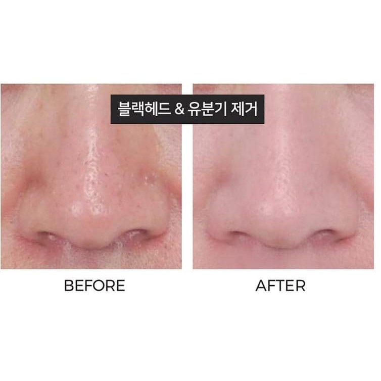 TẨY DA CHẾT DẠNG BỌT NEOGEN PORE TIGHT PEELING MOUSSE 80ml | BigBuy360 - bigbuy360.vn