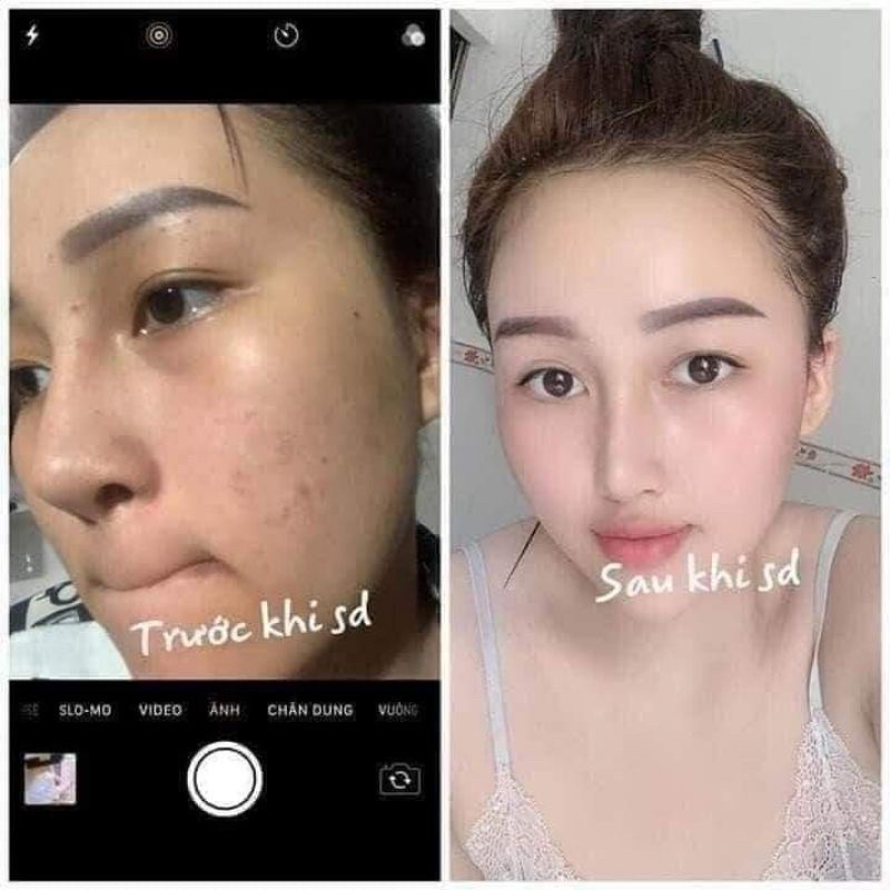 Kem Face Meiduki Nhật Bản Chính Hãng