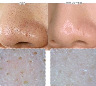 SỮA RỬA MẶT INNISFREE TRO NÚI LỬA