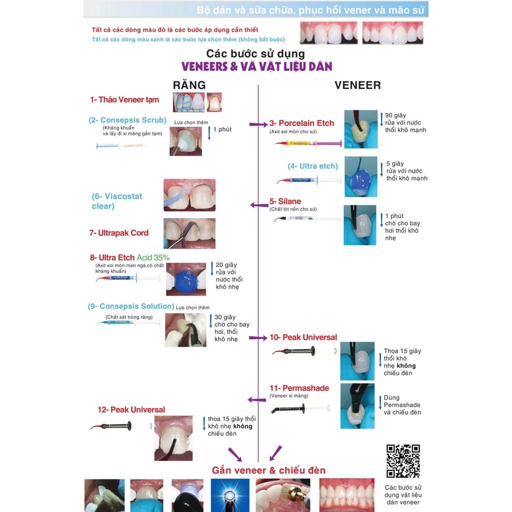 Vật liệu vá, sửa sứ, veneer Etching sứ Pocerlain - Ultradent