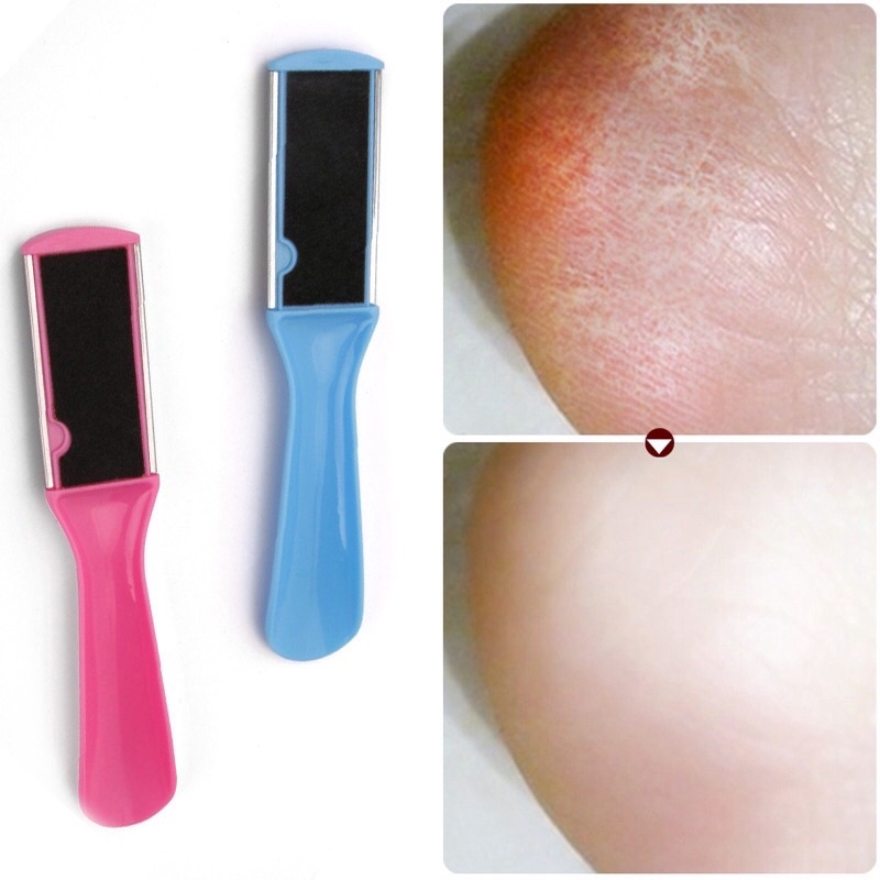 Dụng cụ tẩy tế bào chết cho bàn chân tiện dụng