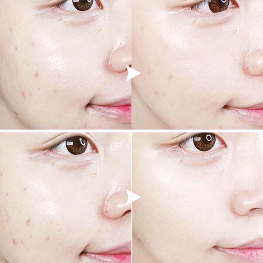 😁😁 🌵 TẨY TẾ BÀO CHẾT HUXLEY | BigBuy360 - bigbuy360.vn