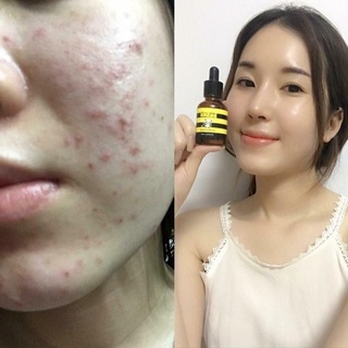 Kem nhím kosxu serum kosxu