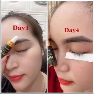[KHUYỄN MÃI] Tinh Chất Kích Mọc Tóc DR.HAIR ZENPALI