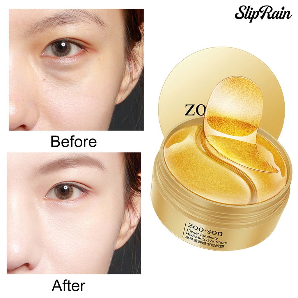 (Hàng Mới Về) Set 60 Mặt Nạ Mắt Chiết Xuất Trứng Cá Muối Tự Nhiên Dưỡng Ẩm Chống Nếp Nhăn | BigBuy360 - bigbuy360.vn