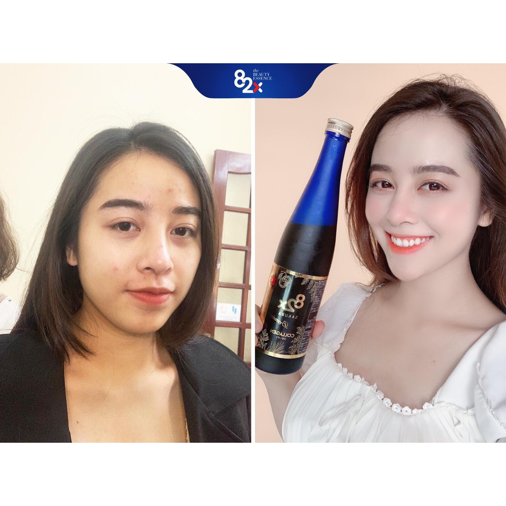 82X COLLAGEN SAKURA PREMIUM (DÒNG CAO CẤP) Dạng Nước 120.000mg Collagen Peptide, Nước Uống Đẹp Da Đến Từ Nhật Bản 500ml