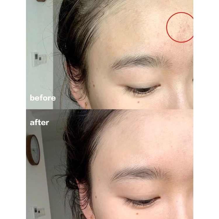 Kem Dưỡng hoa cúc Kiehl's calendula serum-infused water cream 100ml