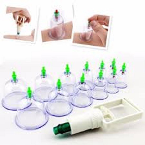BỘ DỤNG CỤ GIÁC HƠI 12 ống hút chân không -KHÔNG DÙNG LỬA