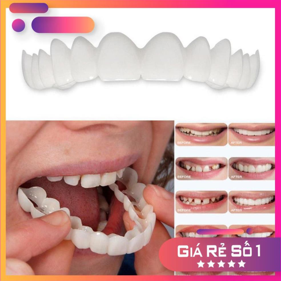 niềng răng tại nhà snapon smile - nẹp răng tại nhà  ( GIAO HÀNG SIÊU NHANH )