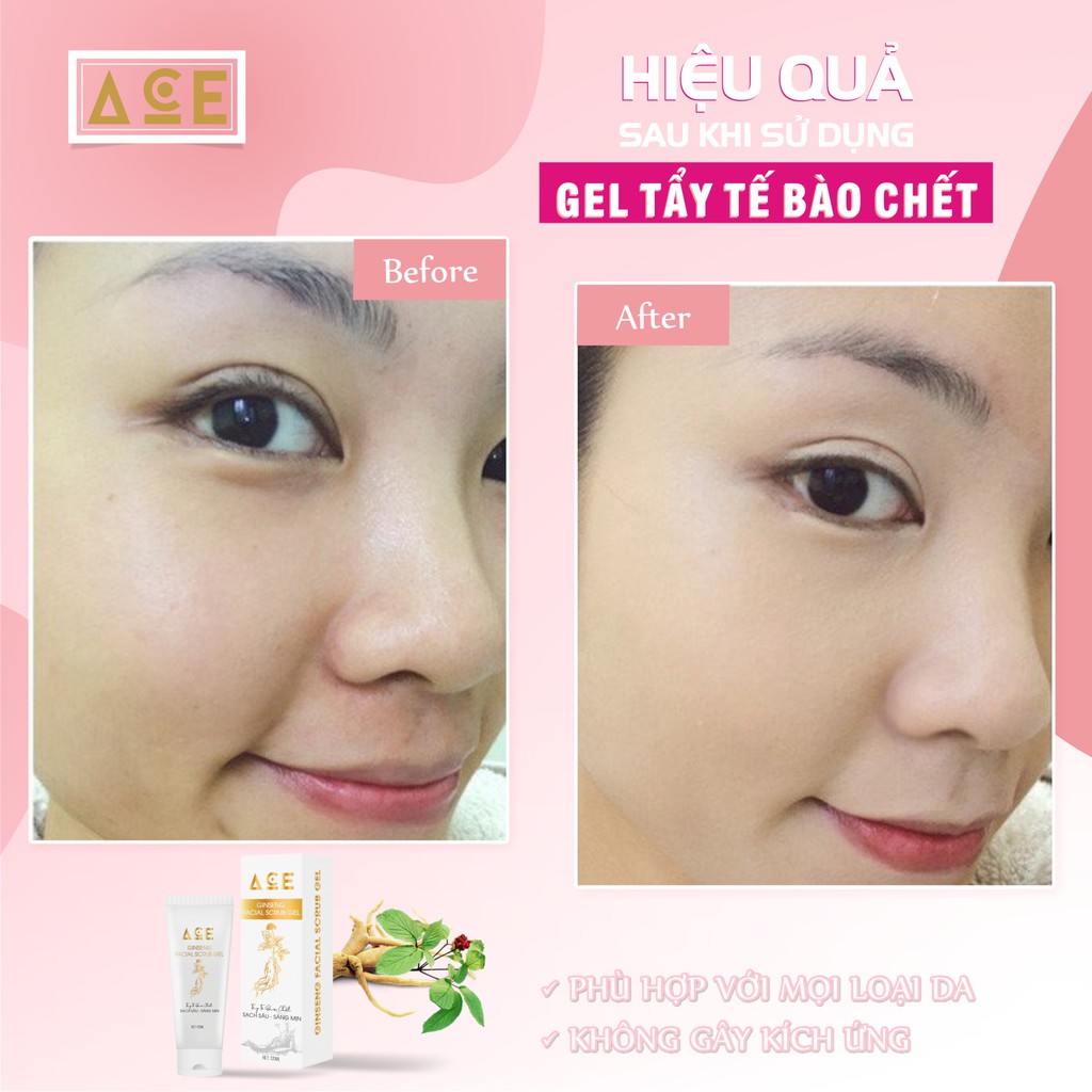 Gel Tẩy Tế Bào Chết ACE Nhân Sâm, Sữa Non (1OOml)