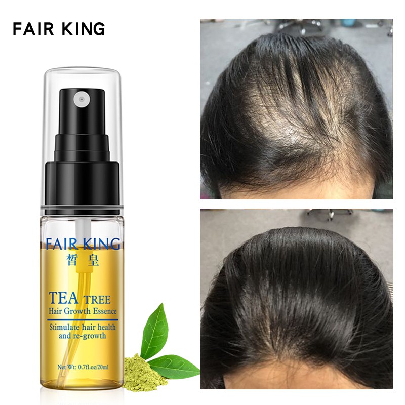 Tinh Chất Cây Trà Fair King 20ml Ngăn Rụng Tóc Và Giúp Tóc Mượt Mà Hơn