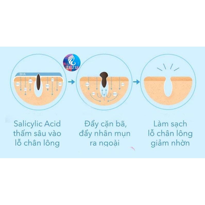 HŨ 120G GEL BHA/ SALYCILYC đắp mặt làm sạch các tế bào chết dư thừa trên da, tan dầu thừa, loại bỏ mụn ẩn, mụn đầu đen
