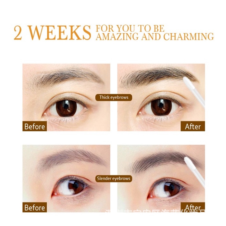 (hàng Mới Về) Serum Kích Thích Mọc Lông Mày / Lông Mi Feg | BigBuy360 - bigbuy360.vn