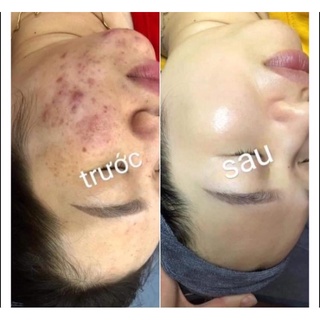 Noãn thực vật .
