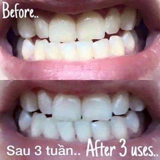 Kem đánh răng Ap24 Mỹ