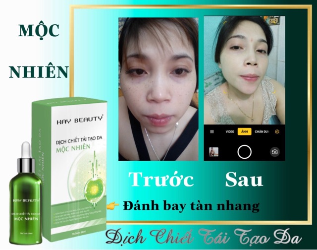 Mộc nhiên đông y (tái tạo da hoàn mỹ)