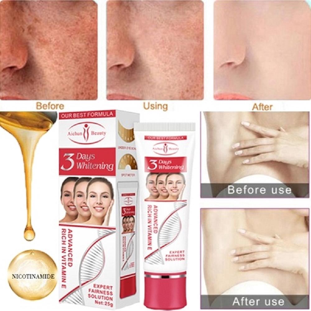 Kem tẩy trắng da làm đẹp cho khuôn mặt và cơ thể hiệu quả