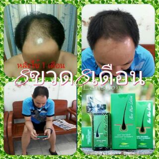 Neo Hair Lotion (Chuyên sỉ)