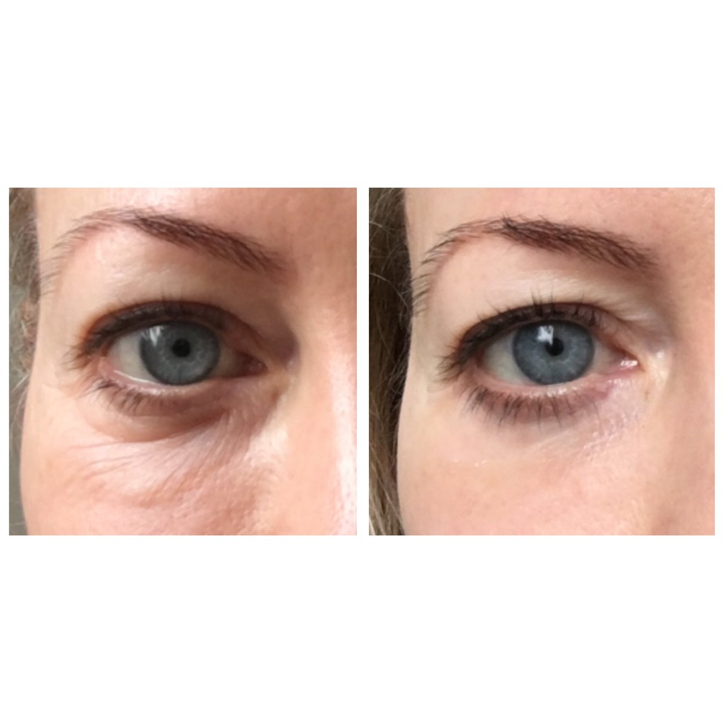 Chăm sóc vùng da mắt hãng Q+A sản xuất tại Vương Quốc Anh UK tinh chất huyết thanh Caffeine Eye Serum giảm lão hóa 15ml