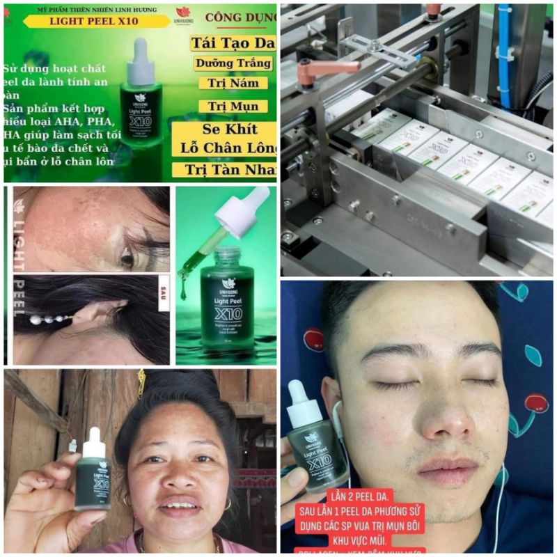 Light Peel x10 Linh Hương( thay da sinh học)tái tạo làn da Việt