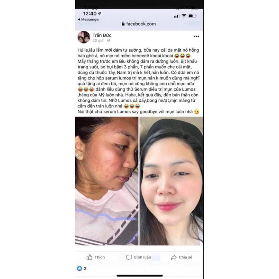 Serum mụn Lumos Ance, sạch mụn, mờ thâm dưỡng trắng da mặt