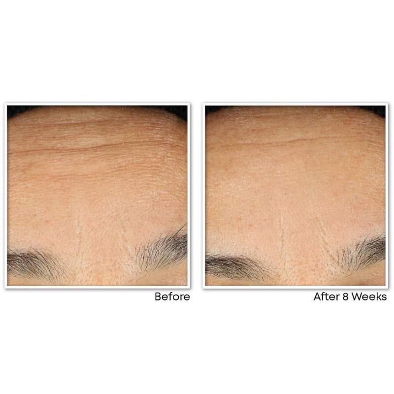 BILL ẢNH CUỐI_ CÓ SẴN KEM DƯỠNG MẮT CHỐNG LÃO HOÁ ROC RETINOL EYE CREAM | BigBuy360 - bigbuy360.vn