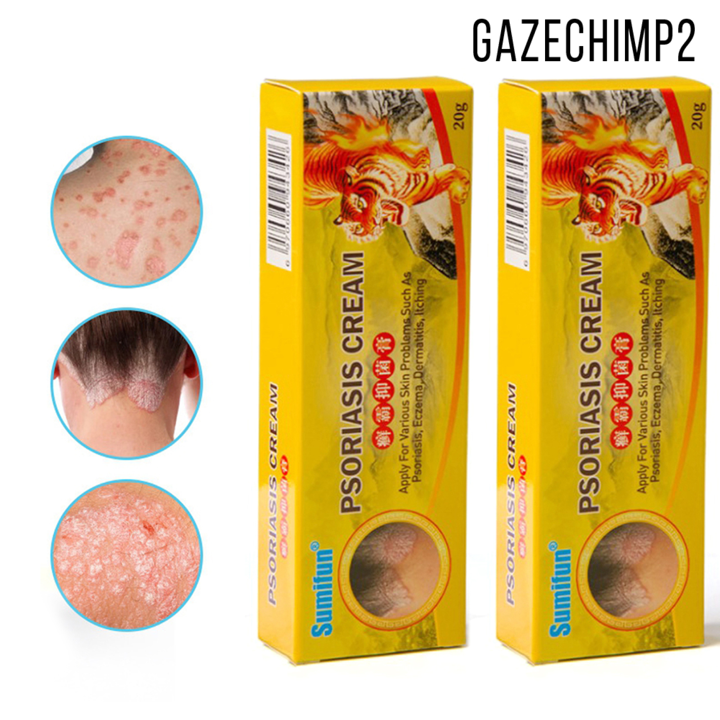 (Hàng Mới Về) Set 2 Tuýp Kem Trị Vẩy Nến / Viêm Da / Viêm Da / Ngứa Gazechimp2 20g