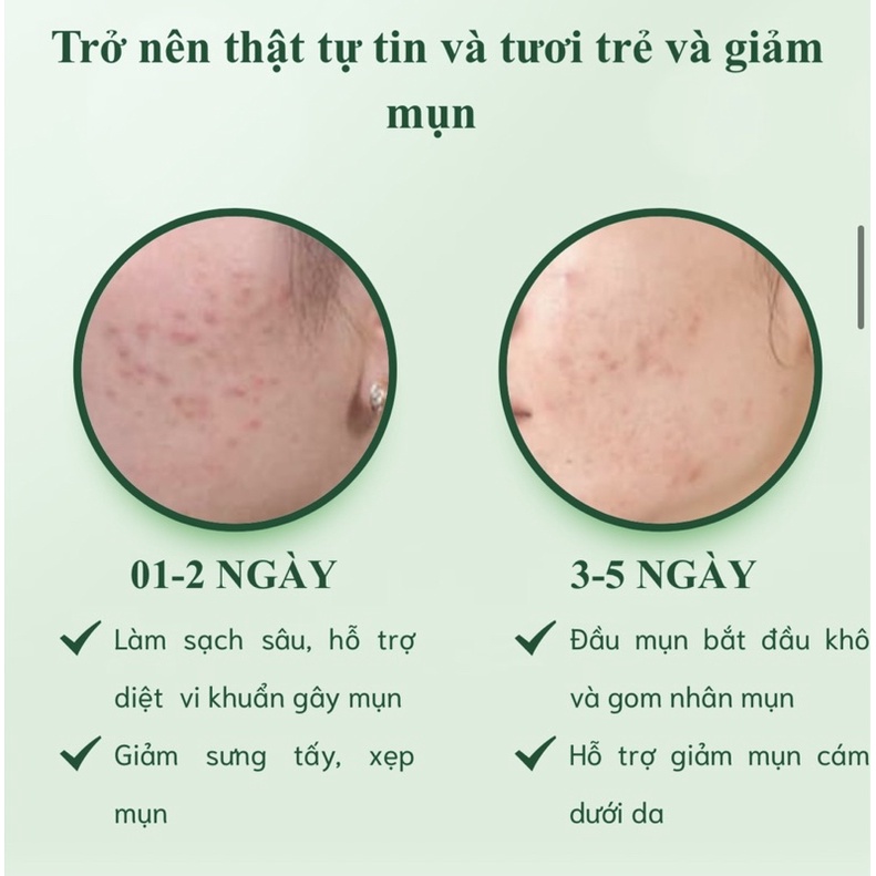 Serum Dr.Skinacnes xoá mụn thâm se lỗ chân lông 5ml