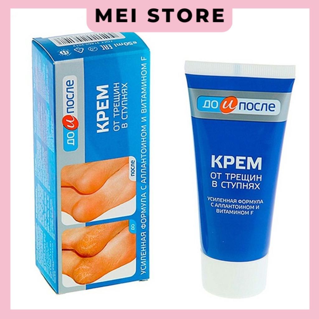 Kem Ngăn Ngừa Và Hồi Phục Nứt Nẻ Gót Chân Kpem Nga 50ml