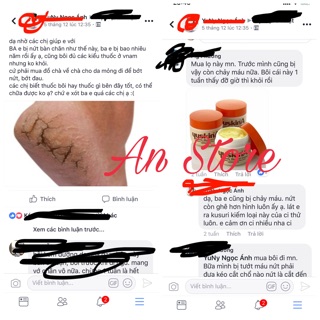 Kem bôi nẻ Yuskin A