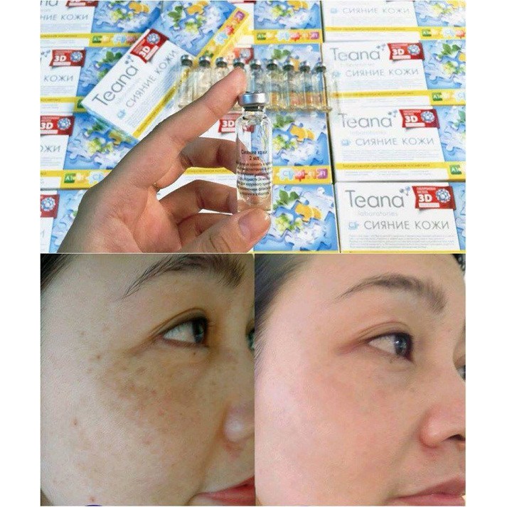 Hộp 10 ống tinh chất Collagen tươi Teana 3D