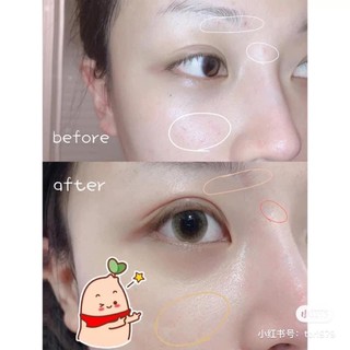 Kem mờ sẹo thâm Avène Cicalfate