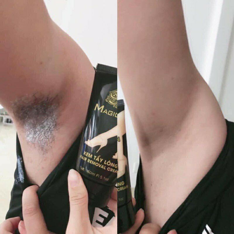 [ CHÍNH HÃNG ] KEM TẨY LÔNG MAGIC SKIN