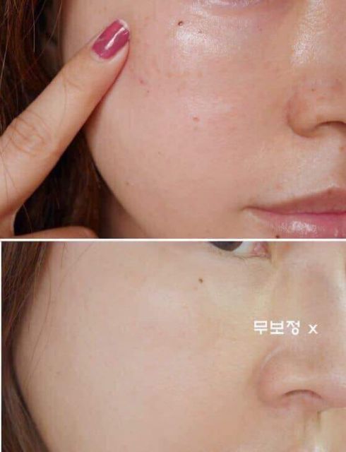 (MẪU MỚI) Kem hỗ trợ làm mờ thâm nám Dongsung Rannce Cream 10g | BigBuy360 - bigbuy360.vn